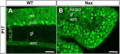 Upregulation of Neural Cell Adhesion Molecule 1 and Excessive Migration of Purkinje Cells in Cerebellar Cortex